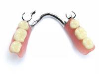 Partial set of dentures