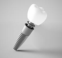 A digital image of a single dental implant and all its parts in Jonesboro