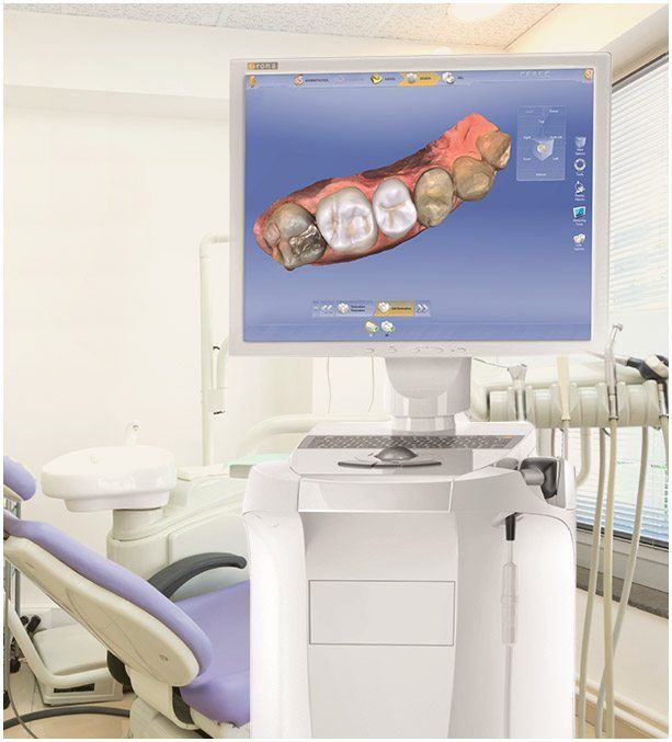 digital image of dental crowns