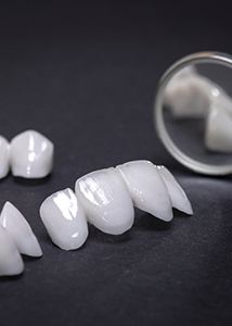 closeup of veneers on table 