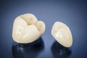 all-ceramic crowns