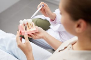 woman holding dental implants model 